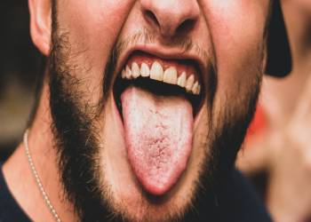 혀 갈라짐의 3가지 원인과 치료 방법