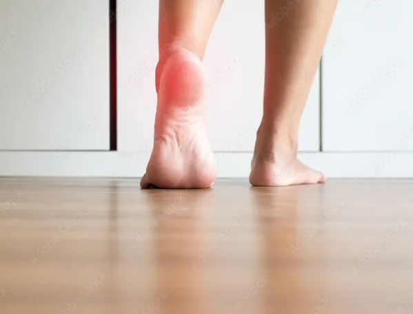 족저근막염 원인과 증상 및 예방과 치료 방법, 발뒤꿈치통증